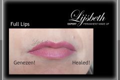 2019-02-18 HT Healed lips PMULijsbeth