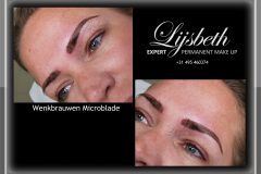 2018-05-05 ZJ Microblade